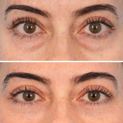 InstaLift PDRN & Collagen Eye Patches