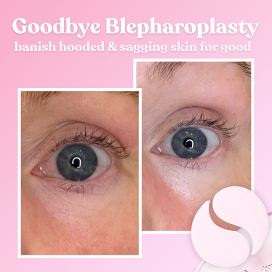 InstaLift PDRN & Collagen Eye Patches